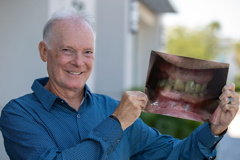 Patient holding up a before photo of their teeth