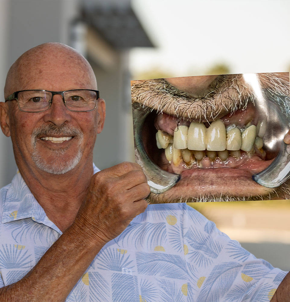 patient holding up before and after photo